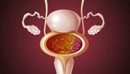 Cystalex medicamento opiniones