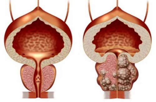 Bururan medicamento opiniones